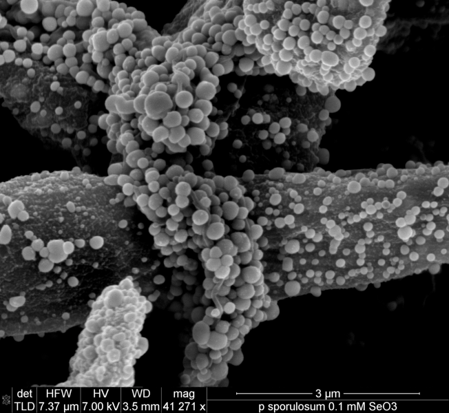 Scanning Electron Microscopy imaging showing closeup of filamentous fungal hyphae coated in nanosized spheres of elemental selenium.